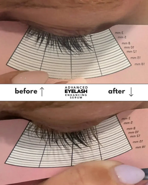 FYNE ADVANCED Eyelash Enhancing Serum